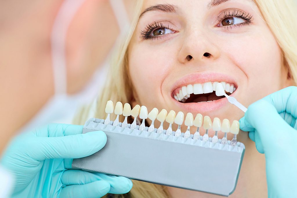 About Teeth Whitening Services | Tower House Dental Clinic
